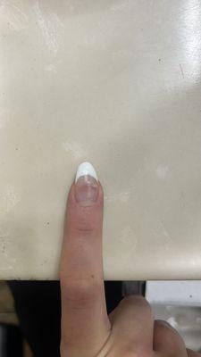 crooked nail