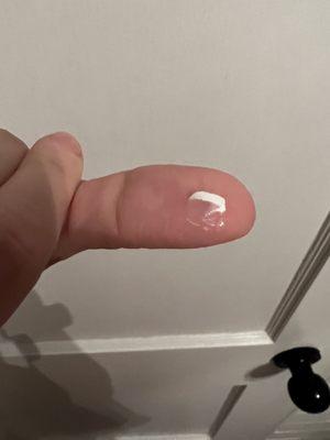 Nail peeled right off