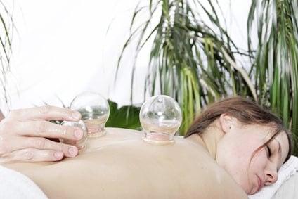 Cupping Therapy