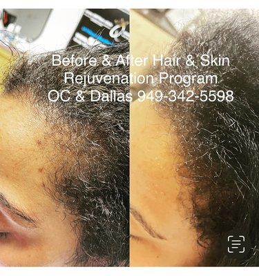 No Tricks, Not Magic it's the most sought after Hair Rejuvenation program with TheQueenOfScalp.com