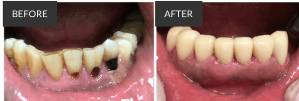 Cosmetic Dentistry