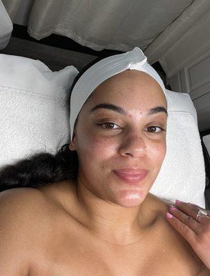 Facial aftermath - my skin was glowing and felt amazing