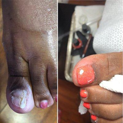 We do miracle at our shop. Give the best pedicure in town.