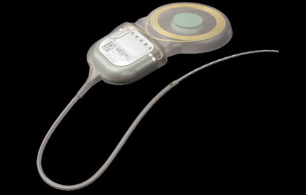 Cochlear Implant