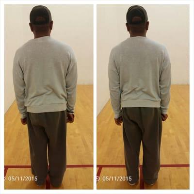 Vance before and after from just one session of 20 minutes of stretching/corrective exercise, relieving his sciatica and low back pain.