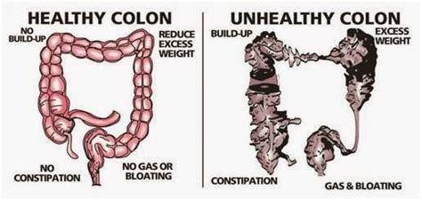 Healthy colon VS Unhealthy colon