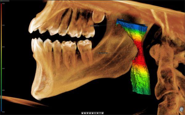 State of the are evaluation of upper airway.