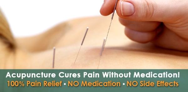 Cure Pain with Acupuncture