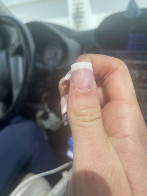 Cut on my cuticle