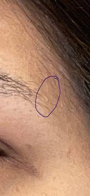 Hardened piece of skin before tattooing of eyebrows.