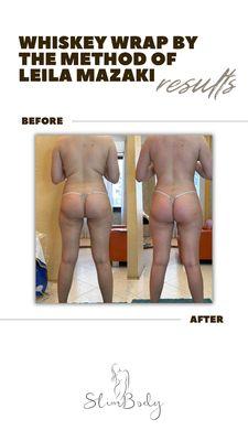 Whiskey Body Wrap: Before & After Results