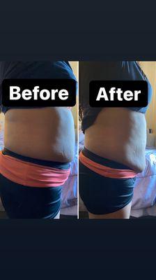 One of my clients who I did an hour session on her stomach area.