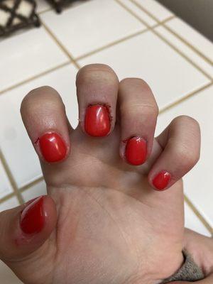 Bleeding cuticles and hang nails