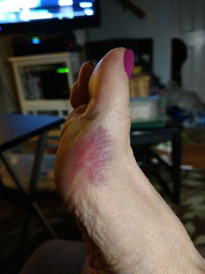 She bruised me by scrubbing my foot like I was a ham bone and also cut my big toe. They used to be great but new owners are horrible now.