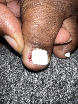 bleeding toe after getting a pedicure.