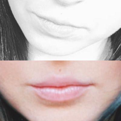 From uneven natural lips with barely anything on top to perfectly even, plump, and STILL natural looking lips!