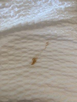 Stain on the bed! Could be feces.