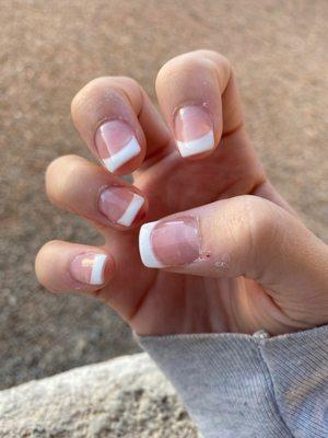 You can see all the dried bits around my nails. I have very healthy hands and try to moisturize every day.