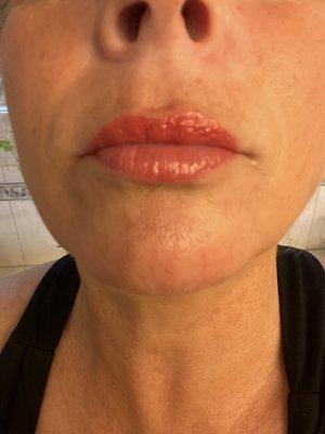 Healed lips