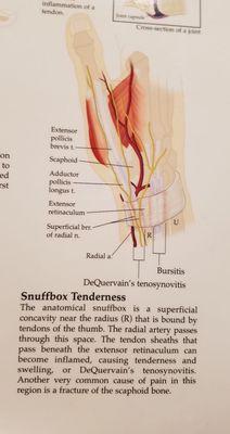 The next time you have Snuffbox Tenderness you know who to call.