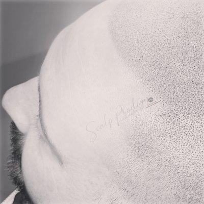 Soft Scalp Micropigmentation at Scalp Prodigy.