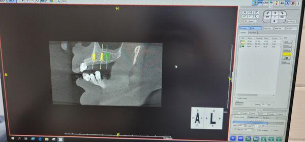 Using latest digital technology in dentistry!!