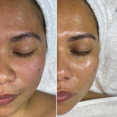 Custom Bioelements facial with some waxing done by Dorthy