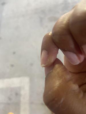 Pinky nail spilt in half