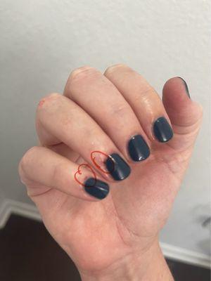 Cuts/tears on 2 nail beds