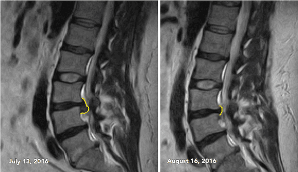 Solon Spine and Wellness Center