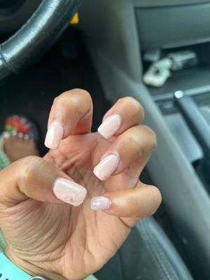 Tore up nails