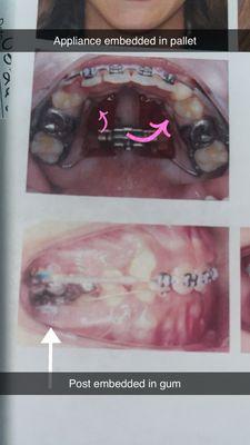 Negligent treatment done by Dr. T