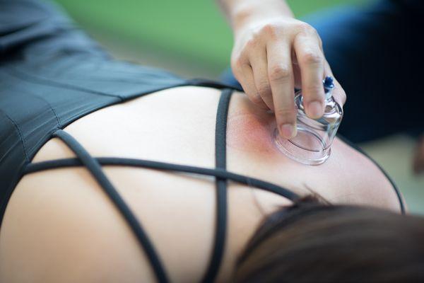 Cupping therapy helps increase blood flow, strip fascia, and promote faster healing.