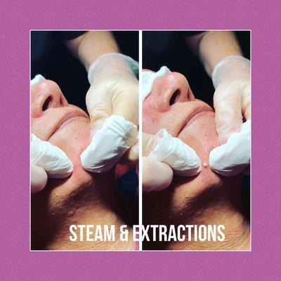 All of our facials come with steam and extractions