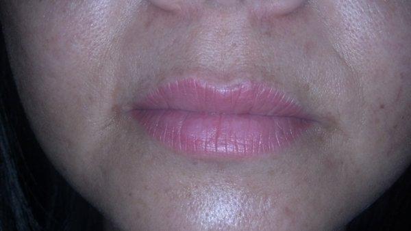 Full Lips... 3 years after