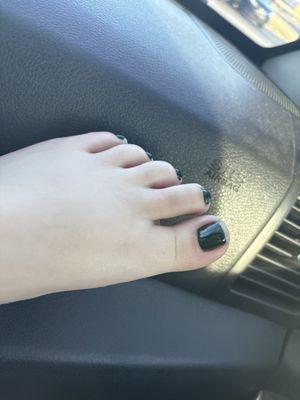 My dark green shellac pedicure. 10/10