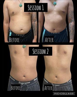 Men body sculpting