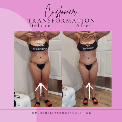 Full Body Contouring with Maderoterapia and two other modalities