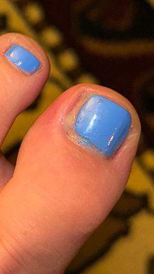 I know it's gross, but WTF?! If you go in for a pedicure here beware you might have an infection the next day.