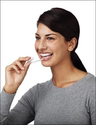 Check if Invisalign is the right treatment t for you.