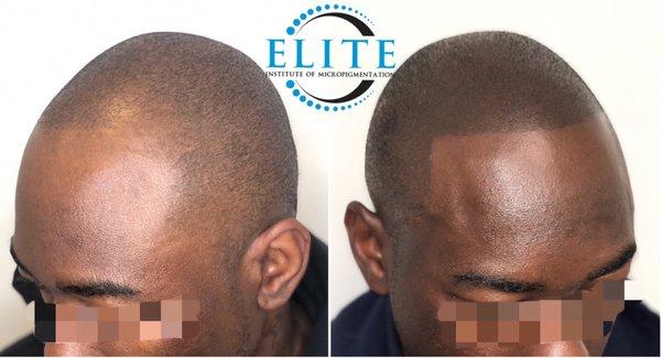 Elite Institute of Micropigmentation