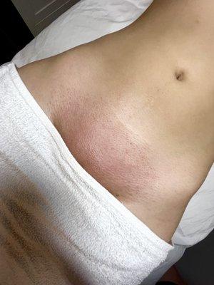 Brazilian sugaring