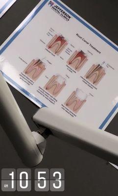 Charts in the rooms. To help explain procedures