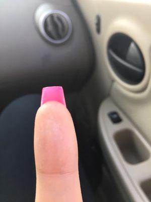 Top of my nail is slanted