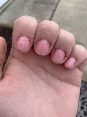 It looks like the nails are already grown out. She missed spots. A 5 year old could have done better.