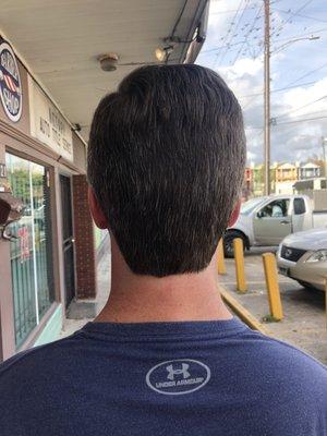 Back of head