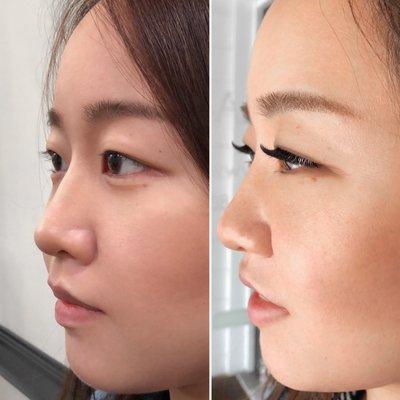 Before & After 
 5D Volume lashes