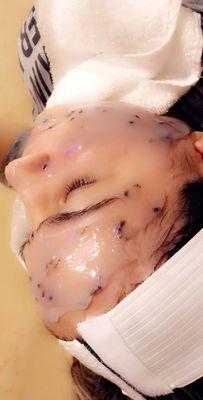 Intensive aftercare hydrojelly facial