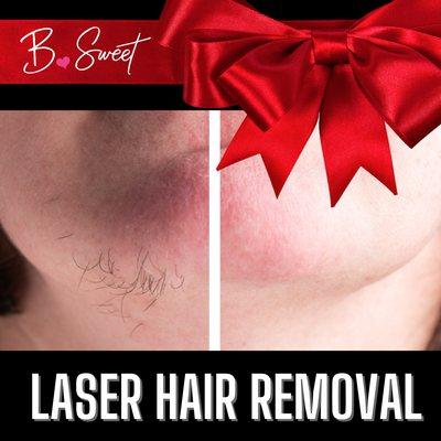 Laser Hair Removal Gift