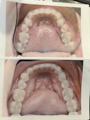 Before: top, After: bottom